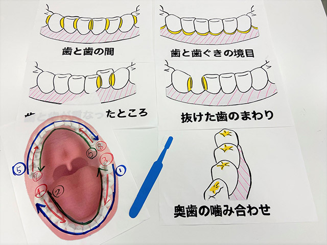 写真②