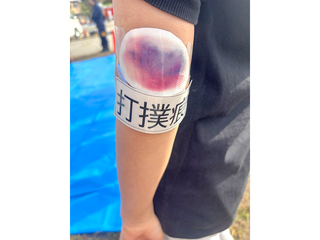 ケガが生じたことを示したカードを貼りました